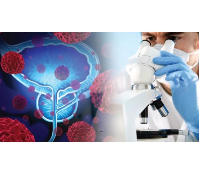 Boron Supports Optimum Prostate Health